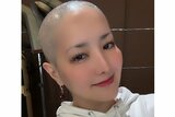 【がん闘病】希良梨さん　「人生初」丸刈り姿を公開　「抗がん剤の副作用で、髪の毛が抜け落ちてきました」「悔しくて涙が止まりませんでした」|TBS NEWS DIG