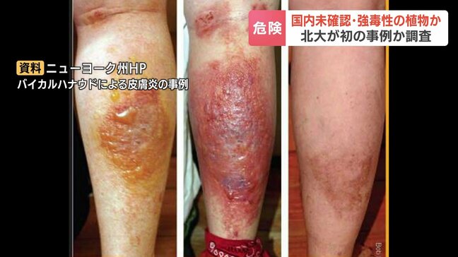 国内未確認の強毒性植物か　北大構内で見つかる…樹液が皮膚につくと重い皮膚炎　撮影した女性は「アジサイのような白い花」環境省などが調査|TBS NEWS DIG