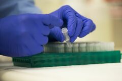 栄研化学、ダルトンから新たな取締役候補者推薦の書面を受領| TBS CROSS DIG with Bloomberg