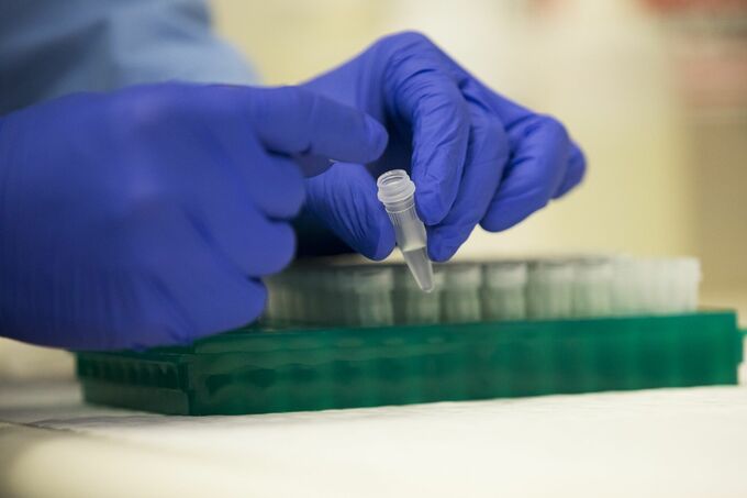 栄研化学、ダルトンから新たな取締役候補者推薦の書面を受領