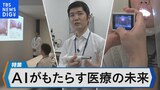 「のどの画像」でインフル診断を支援　AI技術がもたらす医療の未来とは【Bizスクエア】|TBS NEWS DIG