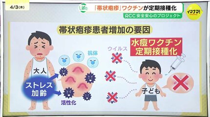 なぜいま？「帯状疱疹」ワクチンが定期接種化 予防したいのはより辛い  