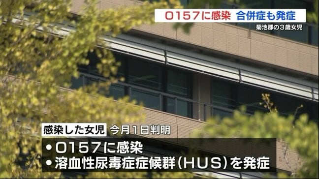 3歳の女の子がO157に感染 合併症で急性腎不全(HUS)も 周囲でも複数人の感染者 熊本県菊池郡|TBS NEWS DIG