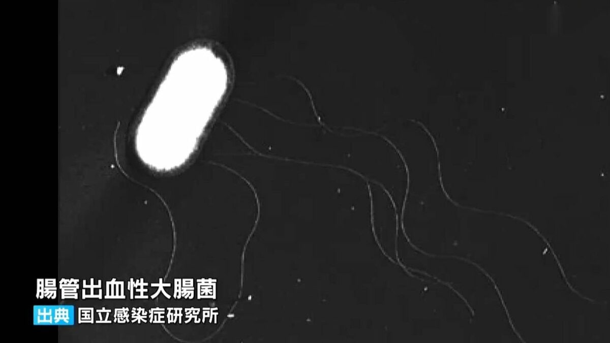 2歳男児が腸管出血性大腸菌O111感染　鹿児島県「食材よく洗って十分加熱して」