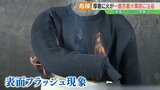 毛羽立ち多いセーターは注意！数秒で燃え広がる「表面フラッシュ現象」着衣着火の恐ろしさ|TBS NEWS DIG