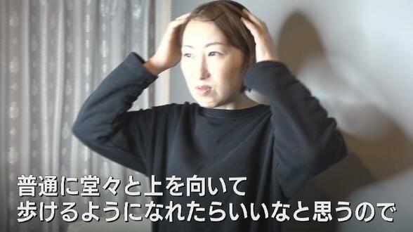 「病気でも堂々と上を向いて歩きたい」抗がん剤治療で髪を失う不安…子宮頸がん患った女性　アピアランスケア通して見つけた “前向きな自分”　|　富山のニュース｜天気・防災｜チューリップテレビ