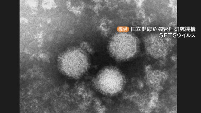 マダニ媒介の感染症｢SFTS｣ 岐阜で初の感染報告 感染者の60代女性は快方へ 県は草むらなどに入る時の対策を呼びかけ|TBS NEWS DIG