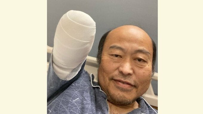 【糖尿病】右腕切断の佐野慈紀さん「後悔しても元には戻らない」ファンに「体に耳を傾けて」切実な思い|TBS NEWS DIG