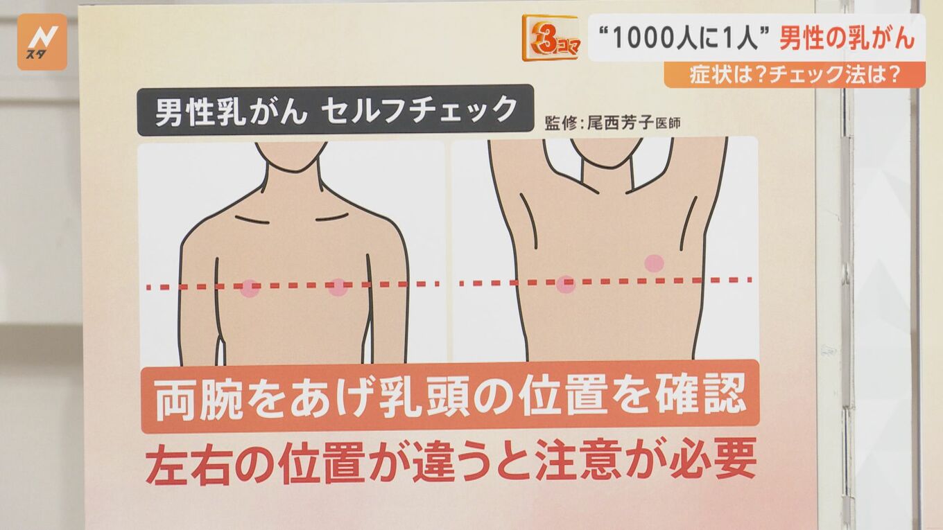 男性にもありますか？男性乳がんを理解する