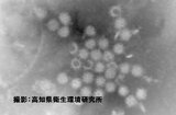 ノロウイルス集団感染 園児111人のうち12人に嘔吐、下痢、発熱などの症状…6人がノロウイルスによる感染性胃腸炎と診断 今シーズン県内1例目(高知) | 高知のニュース・天気|KUTV NEWS | KUTVテレビ高知