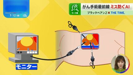 色で「がん手術の失敗を防ぐ」ものから仮想心臓で「異変を察知」まで