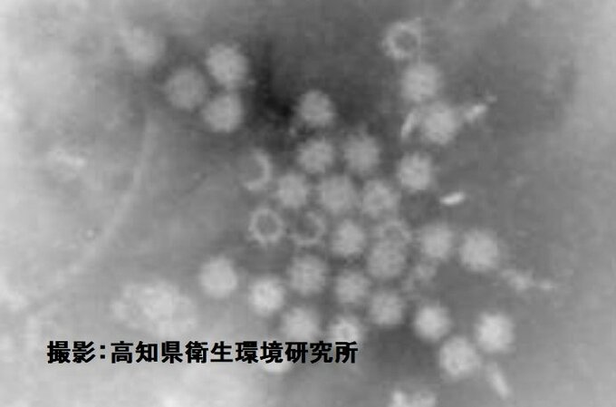 ノロウイルス集団感染　園児111人のうち12人に嘔吐、下痢、発熱などの症状…6人がノロウイルスによる感染性胃腸炎と診断　今シーズン県内1例目（高知）　|　高知のニュース・天気｜KUTV NEWS | KUTVテレビ高知