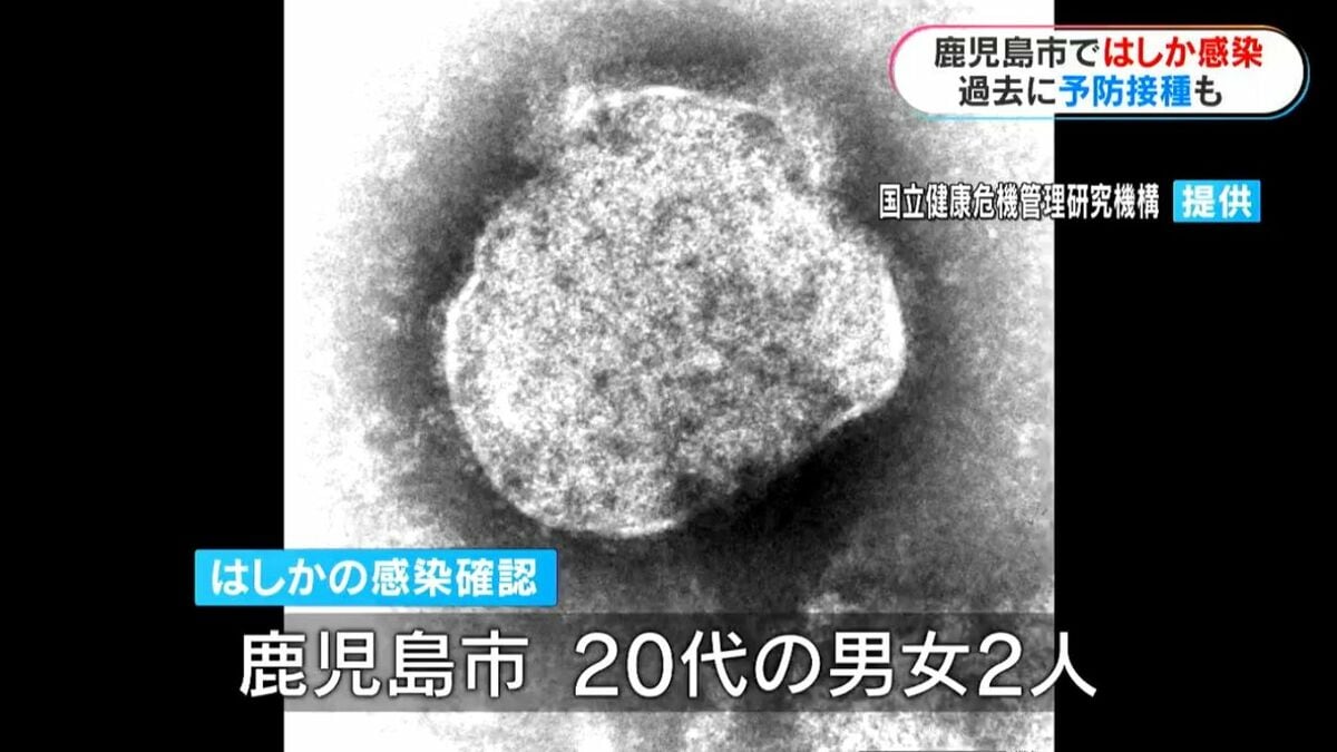 20代男女2人はしか感染　過去に2回予防接種「重症化防ぐため接種を」　鹿児島市