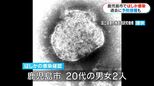 20代男女2人はしか感染　過去に2回予防接種「重症化防ぐため接種を」　鹿児島市|TBS NEWS DIG