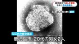 20代男女2人はしか感染　過去に2回予防接種「重症化防ぐため接種を」　鹿児島市|TBS NEWS DIG