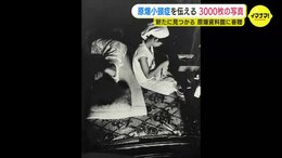 「震える手で撮影した」母親の胎内で被爆 原爆小頭症の被爆者たち 約3000枚の写真が新たに見つかる 原爆資料館に寄贈・保存活用へ|TBS NEWS DIG