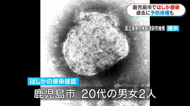 20代男女2人はしか感染 過去に2回予防接種「重症化防ぐため接種を」 鹿児島市|TBS NEWS DIG