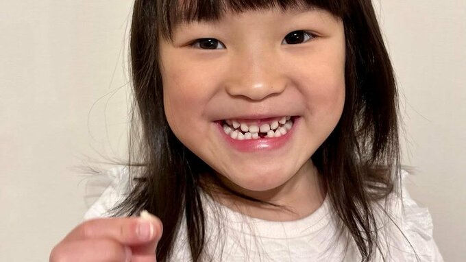【ののちゃん】村方乃々佳さん「今日乳歯が抜けました」「6年間ありがとう」フォロワー祝福「歯生えたら大事にするんだよ」|TBS NEWS DIG