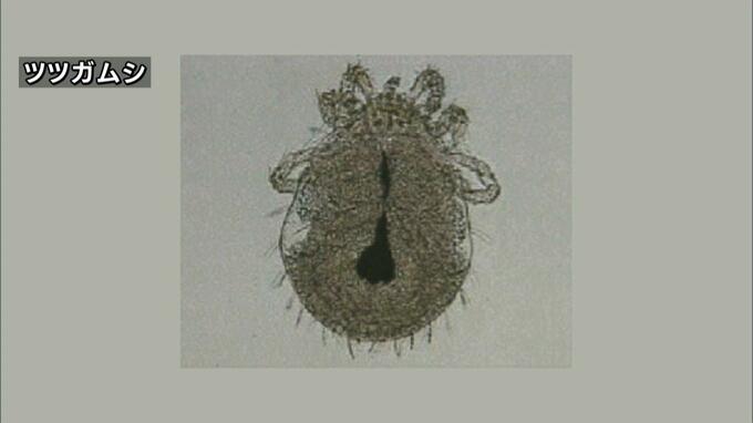 つつが虫病で80代女性が死亡　県「草むらに入る際は肌の露出を避けて」|TBS NEWS DIG