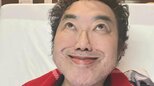 【コロッケ】緊急入院 “膝以外にも治療が必要” 　松平健さんとの3月～4月の公演は中止に　 “払い戻しは詳細が決まり次第お知らせ” |TBS NEWS DIG