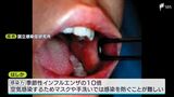 増えるはしかの感染…コロナ禍で予防接種率低下 世代で違う対処「皆が震え上がるのは適切ではない」 | 静岡のニュース | SBSNEWS | 静岡放送