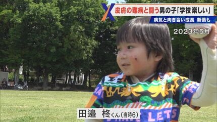 o511 震え萎び病の膿疱群 マゴットキン・オヴ・ナーグル：震え萎び病の膿疱群 ケイオス Games