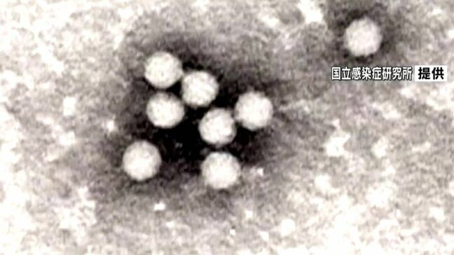 手足口病　県内感染者　先週から84人増える　鹿児島|TBS NEWS DIG
