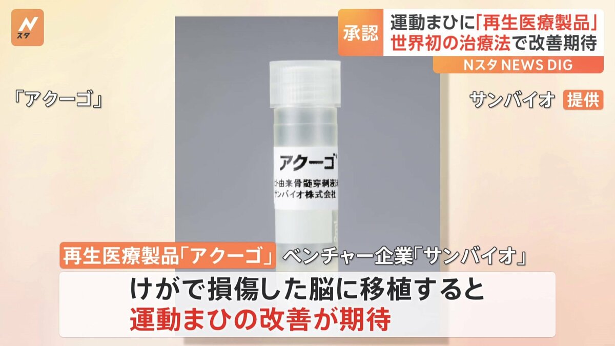 脳の機能の回復を促す再生医療製品 条件付きで厚労省が承認 世界初の治療法で外傷性脳損傷による運動まひを改善 | TBS NEWS DIG