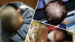 「“風邪と同じだから大丈夫”はとんでもない暴論」子どものコロナ後遺症　軽視できないデータと当事者の証言| TBS CROSS DIG with Bloomberg