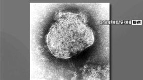 【速報】都内の今年の「はしか」132人で過去10年の最多を上回る　症状がある場合は「受診前に病院へ連絡を」|TBS NEWS DIG