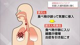 災害時の口腔ケア　事前の備えとケアのポイントは?　熊本地震で被災地支援の歯科医師に聞く　|　MRTニュース ｜ ＭＲＴ宮崎放送