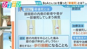 原因は不明『骨壊死』とはどんな病気?治療法や気を付けるべきことを専門医に聞く【ひるおび】|TBS NEWS DIG