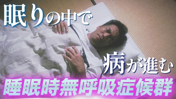 「寝ているとき息が止っているよ」病は夜につくられる～脳卒中や心不全を招く“見えない病”の正体　睡眠時無呼吸症候群とは【全５回シリーズ１回目】|TBS NEWS DIG