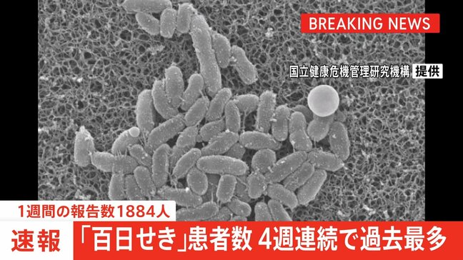 【速報】「百日せき」全国の1週間の報告数1884人　4週連続過去最多|TBS NEWS DIG
