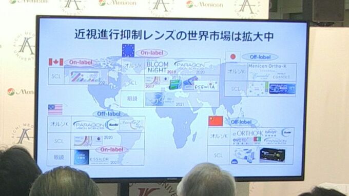 子どもの近視が進行する原因の解明や近視を抑制する機能のコンタクトレンズを研究　愛知医科大学とメニコンの共同プロジェクトで記念式典　|　名古屋・愛知・岐阜・三重のニュース【CBC news】 | CBC web