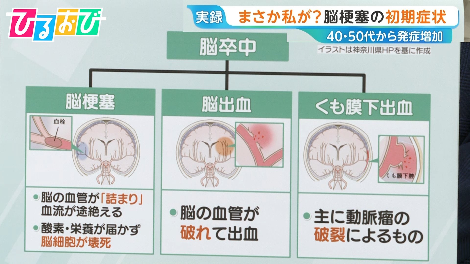 脳 梗塞 の 前兆