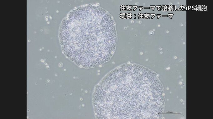 【速報】iPS細胞使ったパーキンソン病患者の再生医療製品「アムシェプリ」 公的医療保険の適用を了承 価格は約5530万円 中医協　|TBS NEWS DIG