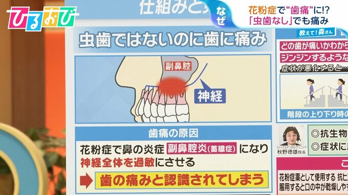 花粉症で「歯痛」に！？虫歯がなくても痛みが出るワケ　「ぎっくり腰」にも要注意【ひるおび】|TBS NEWS DIG