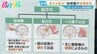 40代から増加「脳梗塞」の初期症状は？「倒れてからじゃ遅い」早期発見のカギ「BE FAST」とは【ひるおび】|TBS NEWS DIG