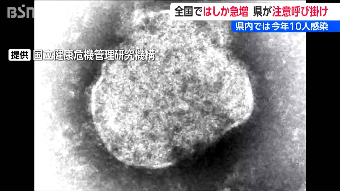 全国の『はしか』感染者数 1週間で1.4倍に急増 新潟県も注意呼びかけ