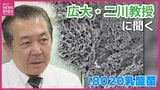 「食道がん手術後の肺炎が減少」歯科（広島大学）と医科（秋田大学）が垣根を越えて連携　Ｌ８０２０乳酸菌　口内環境改善で疾患予防にも効果か|TBS NEWS DIG