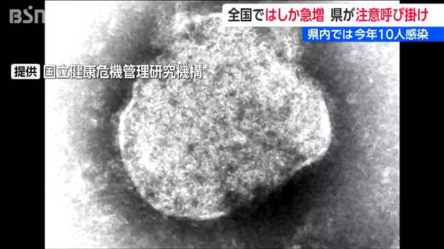 全国の『はしか』感染者数 1週間で1.4倍に急増　新潟県も注意呼びかけ|TBS NEWS DIG