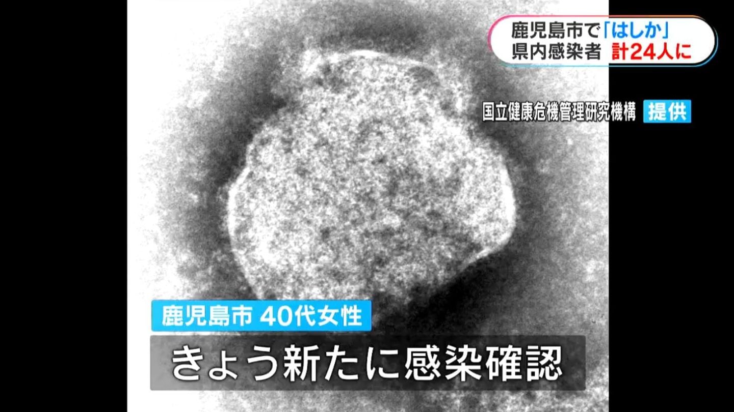 はしか」新たに1人感染 鹿児島県内今年24人に | 鹿児島のニュース｜MBC