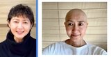 【がん闘病】古村比呂さん 抗がん剤治療による「脱毛」の記録 「参考にしてくれたら嬉しいなと思います」 1年間の写真を公開|TBS NEWS DIG