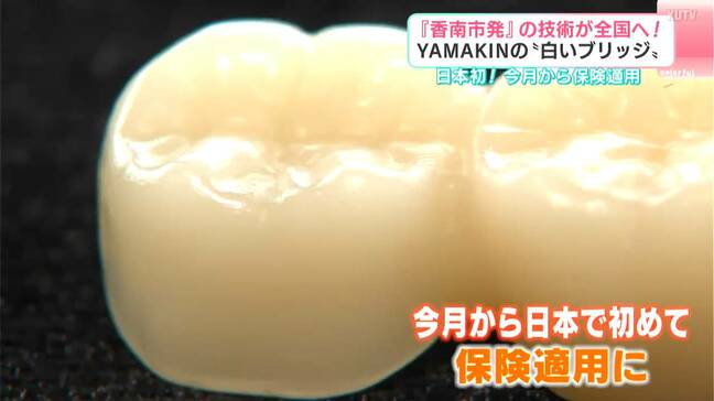 銀歯ではなく“白い歯”のブリッジ、初の保険適用で治療費3割安く　樹脂製の歯科材料「SHIN-BOW」が担う歯科治療の未来【YAMAKIN開発】|TBS NEWS DIG