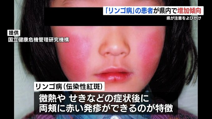 前の年の「15倍以上」熊本県内でもリンゴ病が増加　|TBS NEWS DIG