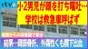小学2年の男児、転倒して頭部を強打し嘔吐も救急車呼ばず… 母親からの再要請で搬送され「頭部骨折、外傷性くも膜下出血」と診断 一時ICUで治療　|　愛媛のニュース - Nスタえひめ｜あいテレビは6チャンネル