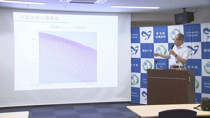 世界で初めて　弱視に対する脳内マリファナ類似物質の働きを解明　鳥取大学医学部などの研究グループ　|　BSSニュース | BSS山陰放送