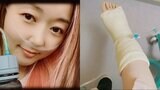 ものまねシンガー・荒牧陽子さん 右足首の手術とステージお休みを公表 「10年以上誤魔化しながら使ってた右足首の靱帯」|TBS NEWS DIG
