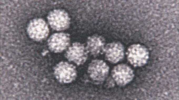 園児や児童ら41人がノロウイルスに集団感染　下痢やおう吐などの症状　北海道旭川市の保育施設　|TBS NEWS DIG